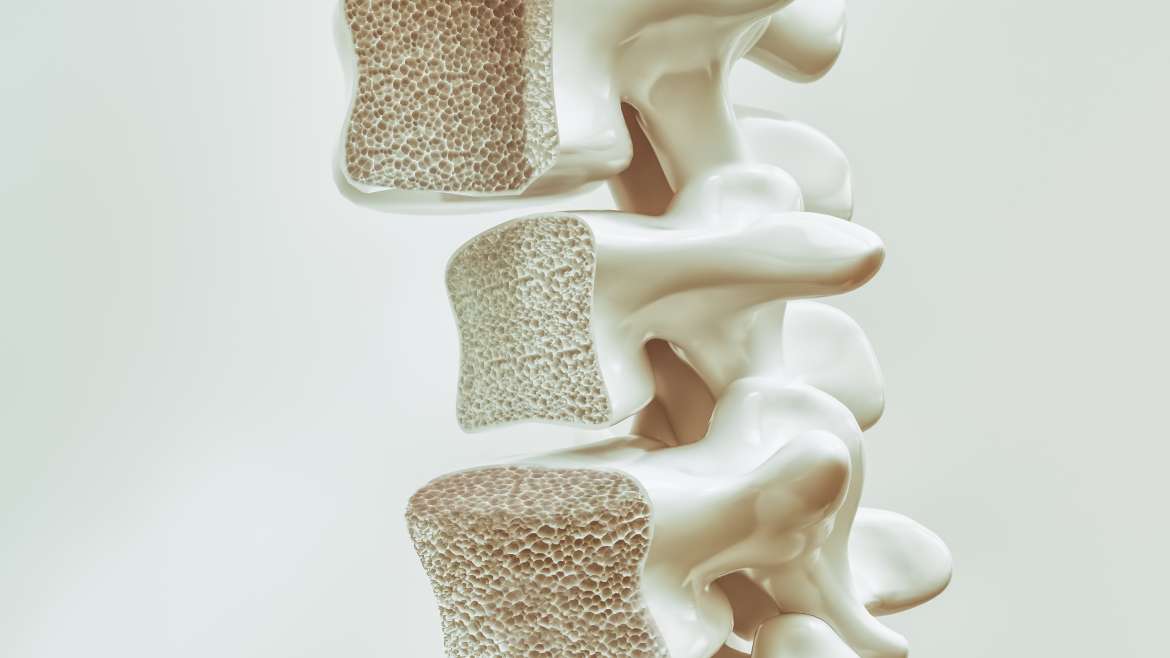 Osteoporosis Pain Reduced with E-PEMF