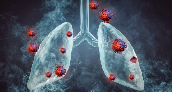Efficacy of Low Frequency Magnetic Field Therapy in Patients with Covid Pneumonia – Clinical Trial